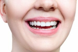 Woman smiling after receiving periodontal therapy treatment