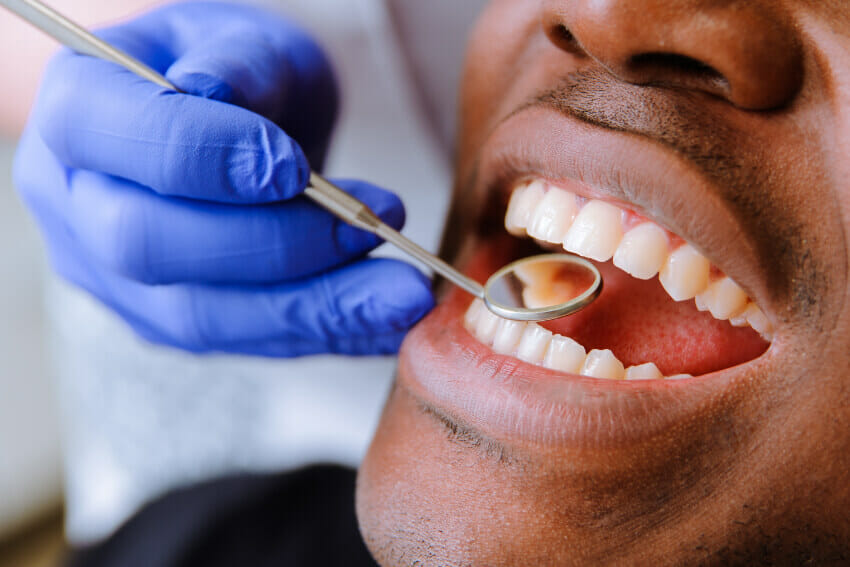 Dentist reviewing the mouth a man who just received a tooth colored filling