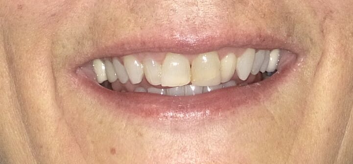 Close up of teeth