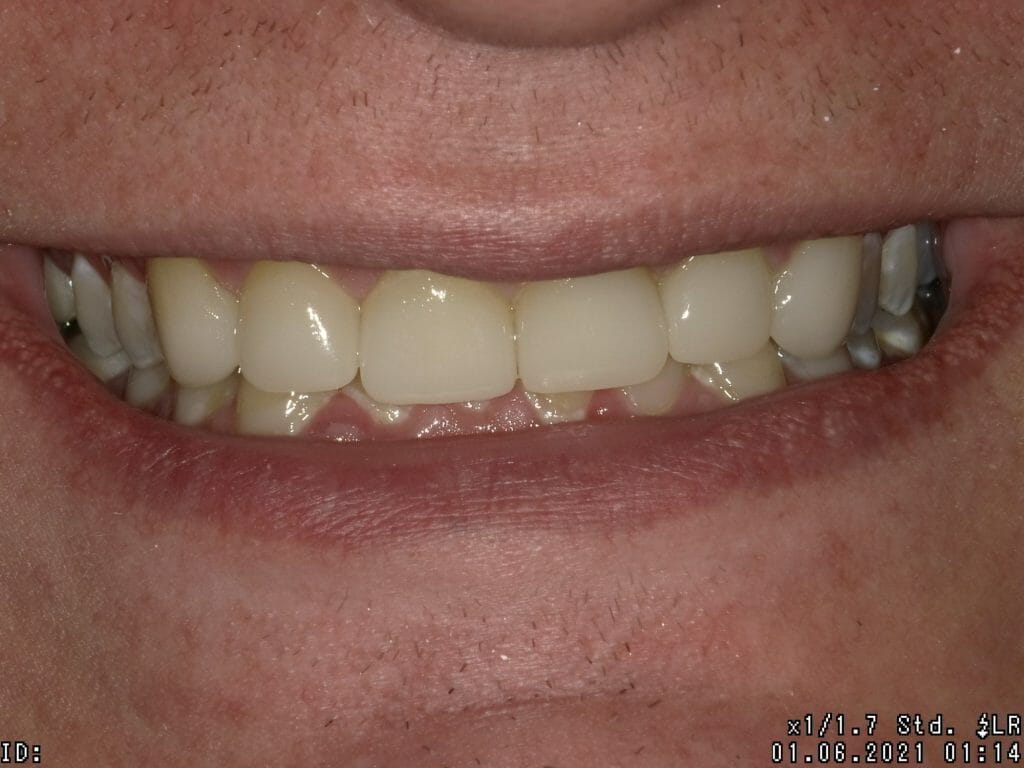 close up of teeth